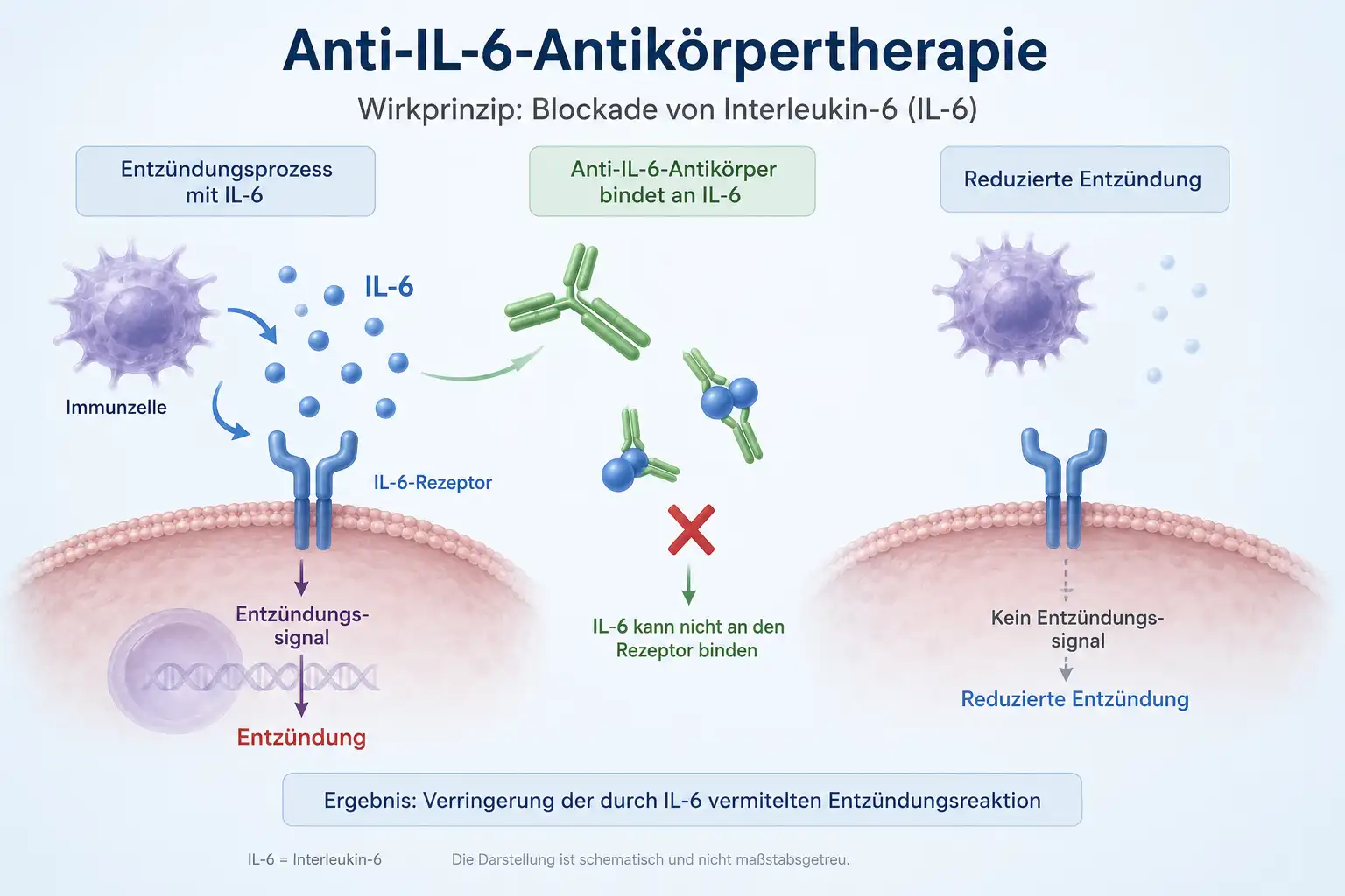 Anti-IL-6-Antikörpertherapie: Vom Fund zum Text
